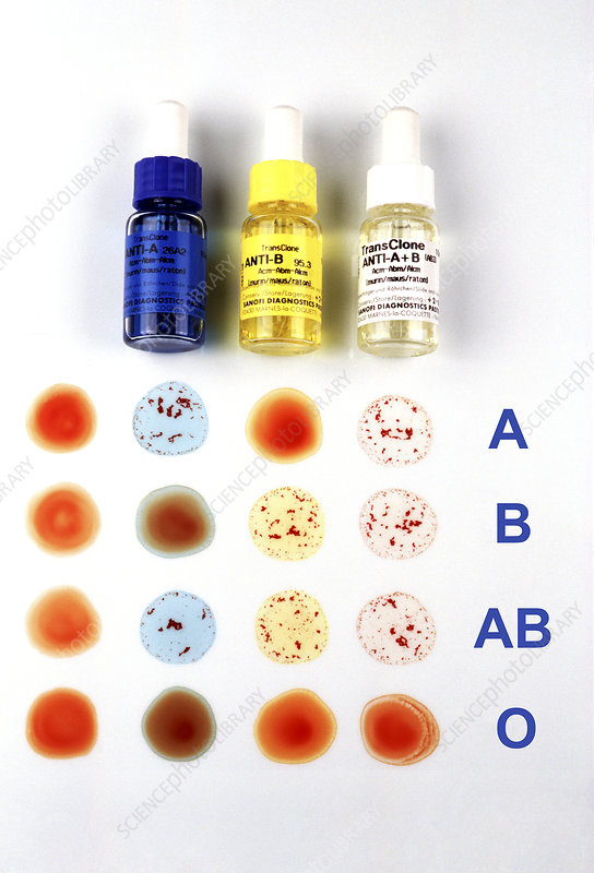 BLOOD GROUP AND RH TYPING BLOOD TEST AT YELAHANKA