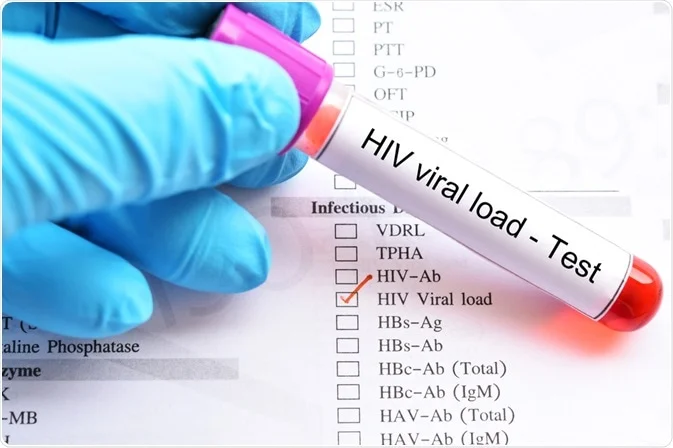 HIV RNA Quantitative PCR OR HIV VIRAL LOAD