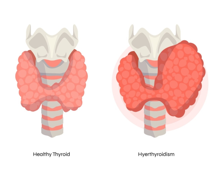 THYROCARE LAB NEAR ME