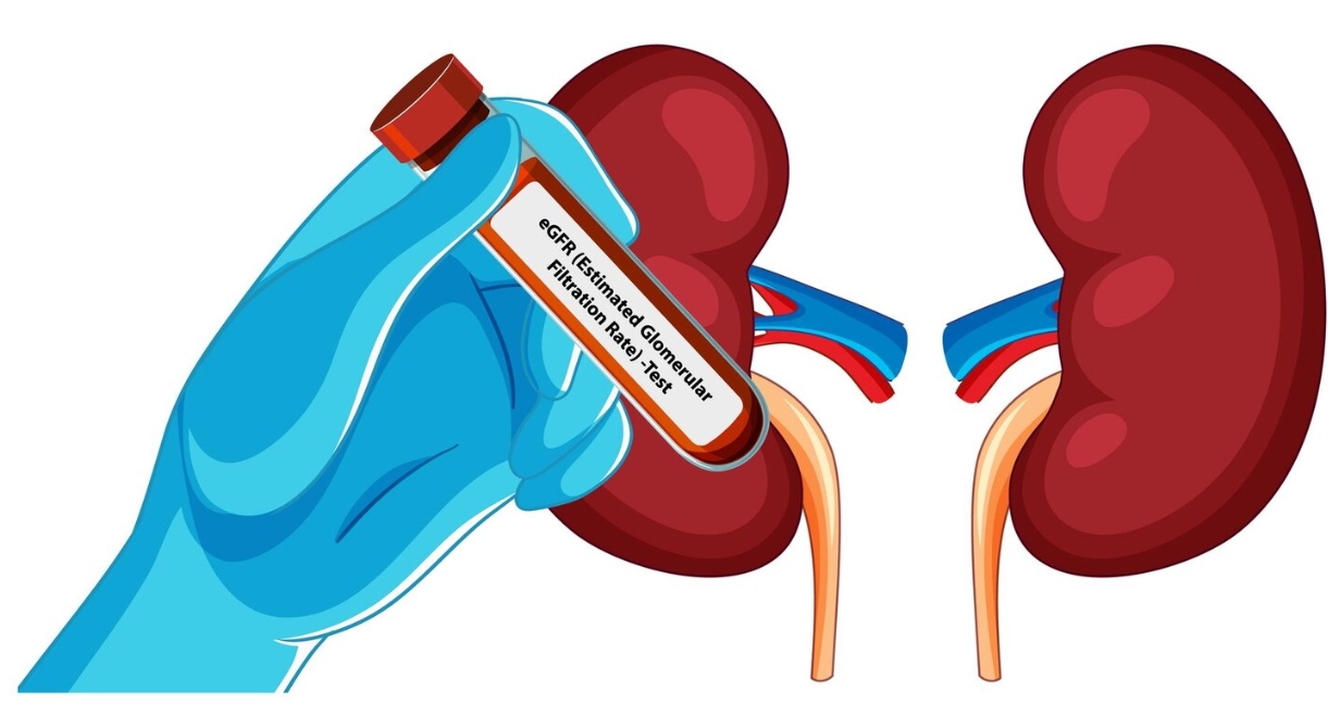 KIDNEY PAIN IN YELAHANKA